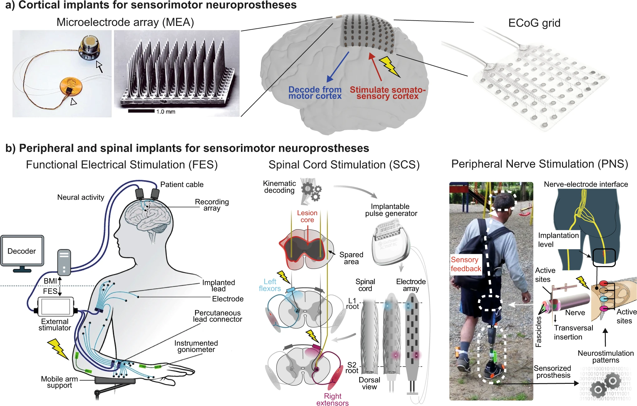 La UMH prueba una inteligencia artificial que adapta los implantes visuales a la respuesta cerebral de una persona ciega